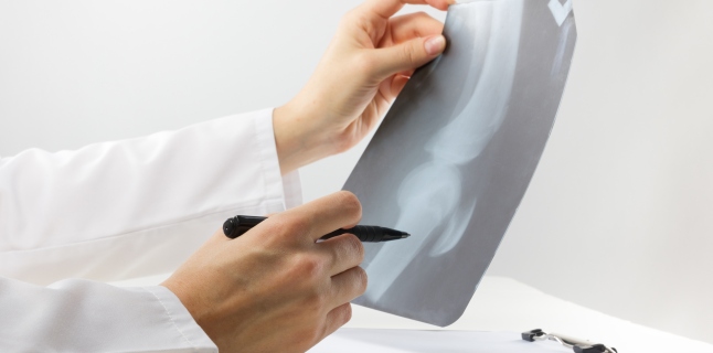 Can osteoporosis be prevented?