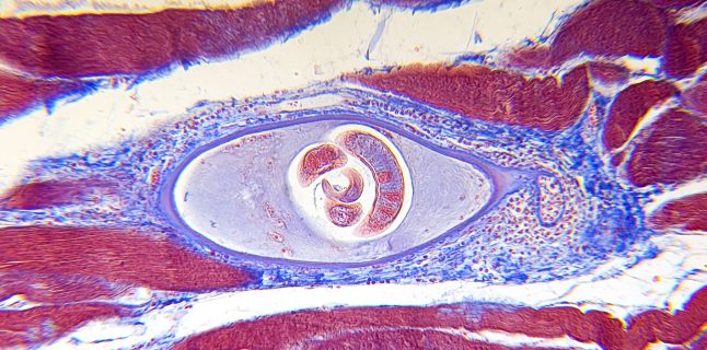 How Trichinelosis Occurs