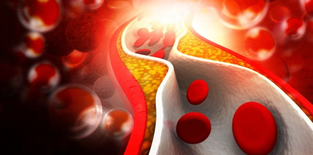 Increased cholesterol: how do you keep it at normal levels?