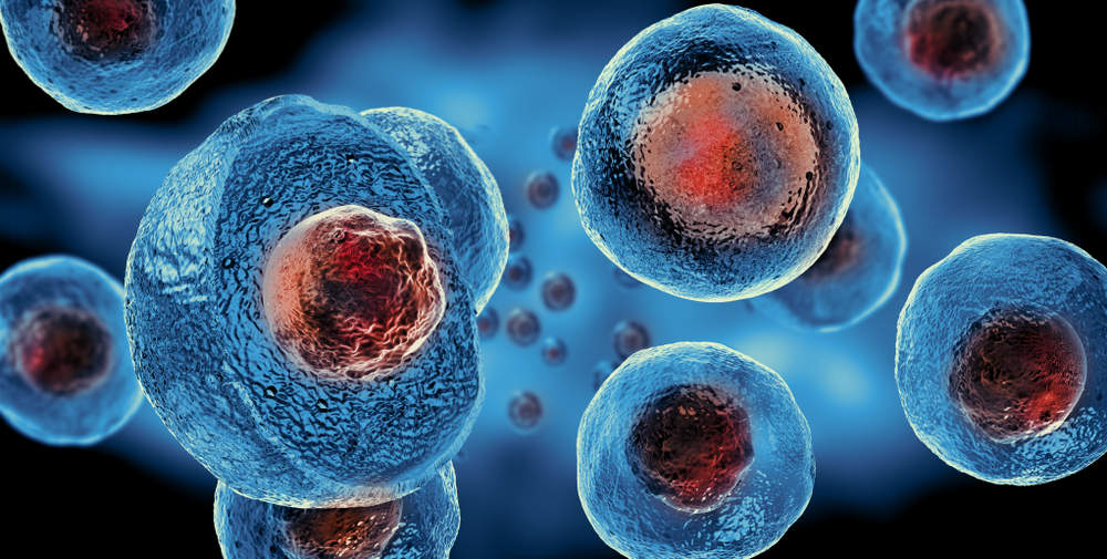 Eficiența celulelor stem în lupta cu boala Lupus