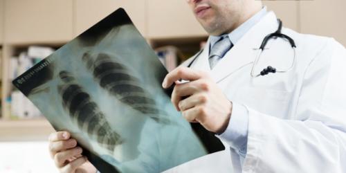 Pulmonary Radiography - When Is It Recommended And Why?