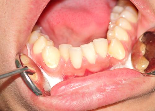 Teeth positioning problems and health: \