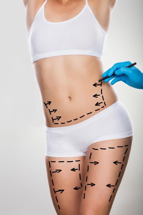 Abdominoplasty and pregnancy: 6 myths disassembled by a specialist