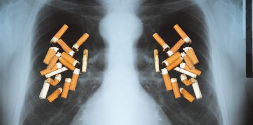 Lung Cancer - How Can You Early Recognize Symptoms?