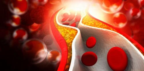 Increased cholesterol: how do you keep it at normal levels?