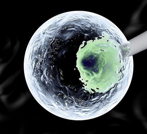 Stem cells harvested at birth are more effective in the case of a transplant than those extracted from the bone marrow