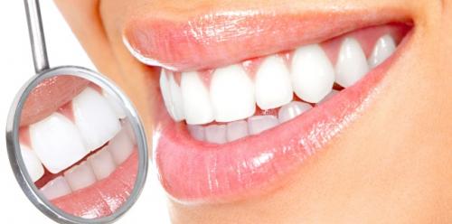 Tooth whitening - causes, treatment