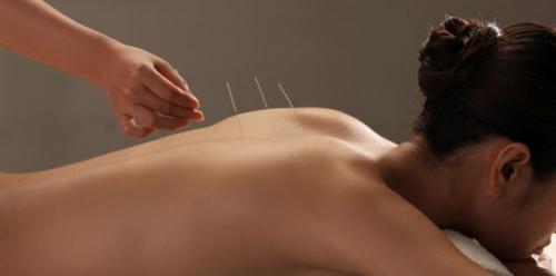 Pros and cons of acupuncture