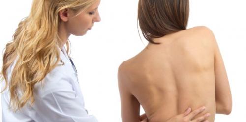 Causes of scoliosis