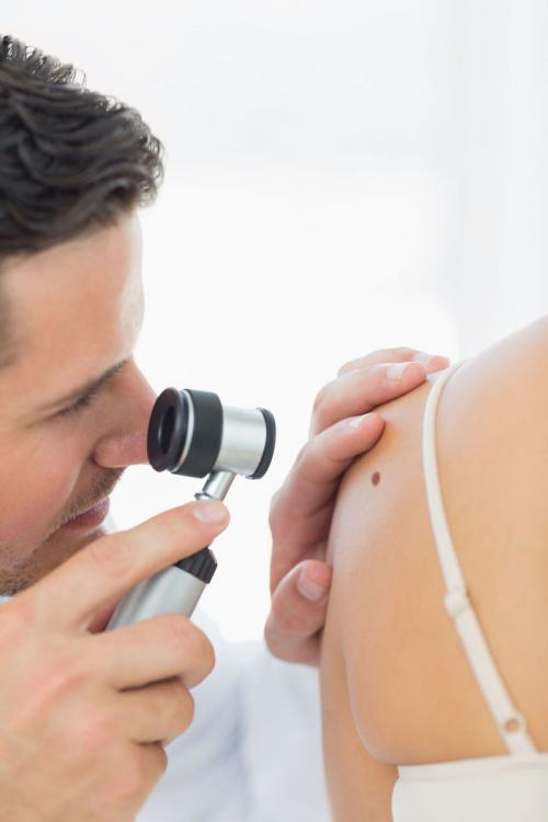 How can melanoma be diagnosed? 