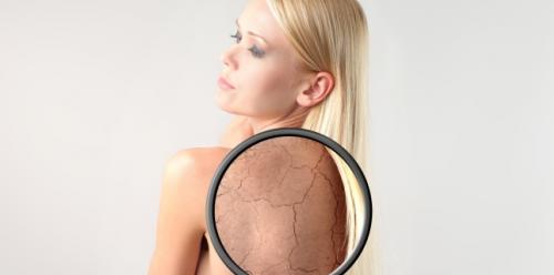 What diseases can indicate dry skin?