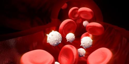 Less known signs of leukemia